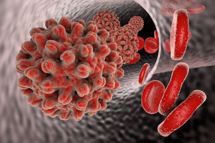 Diseases Caused By Virus Viral fashion items